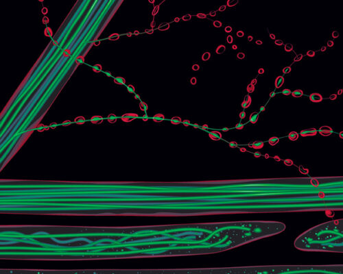 Designer BioMed - Axon Degeneration Illustration