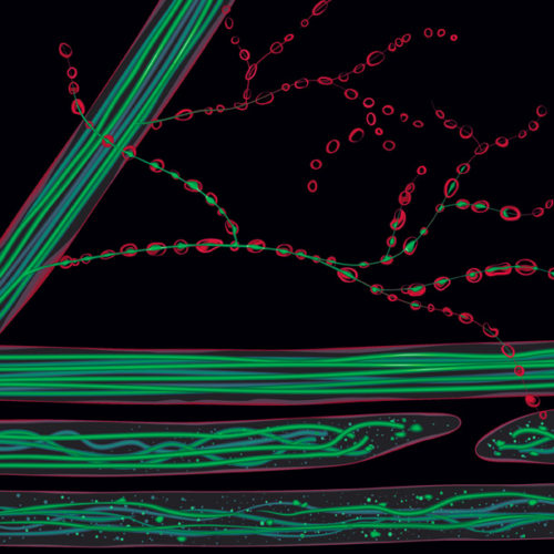 Designer BioMed - Axon Degeneration Illustration Designer BioMed - Axon Degeneration Illustration