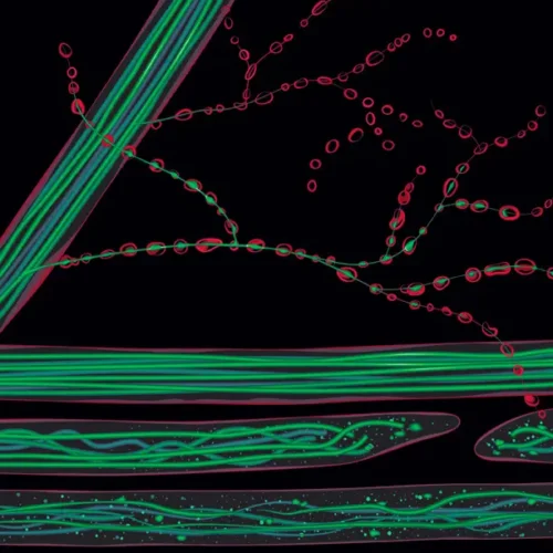 Dmenken designer biomed axon degeneration image (WebP)